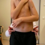 21 Mars 2010. Hugo har möte med ett "sitt-team" inför bygge av elrullstol. En ny sjukgymnast som går igenom Hugos kropp.