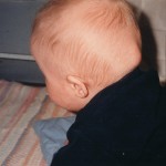 23 Mars 1999. Bara 4 dagar senare. En ny svullnad har tagit form. Hugo är nu 6 månader.