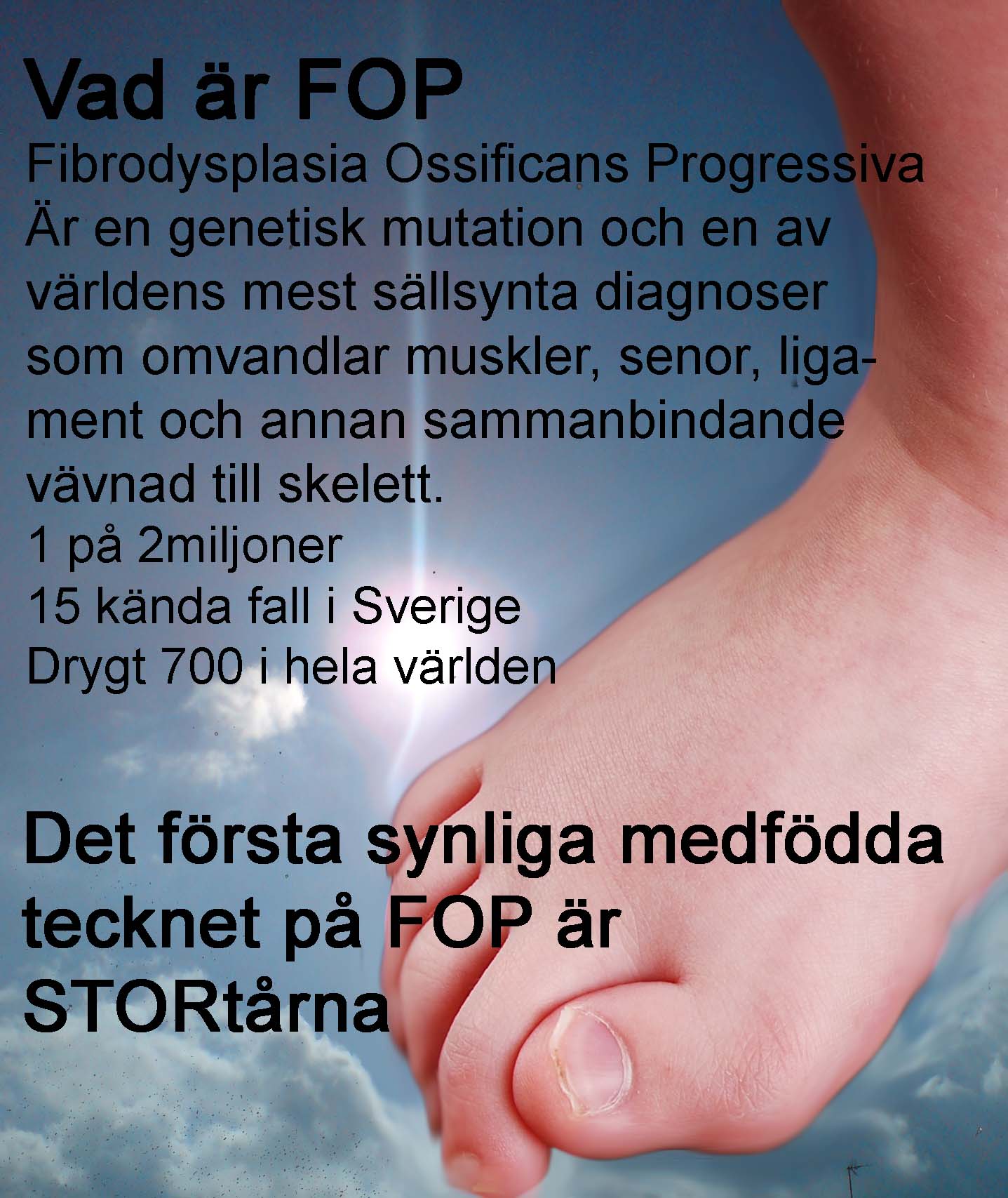 FOP Fibrodysplasia Ossificans Progressiva information till hemsidan