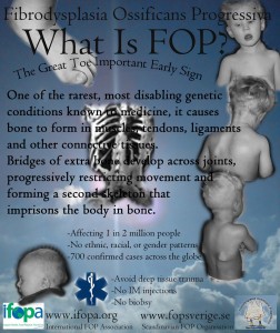 Vad är FOP?