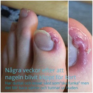 NageltrångMars